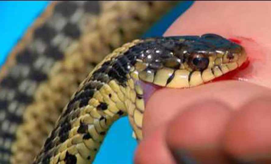 धौलागिरि अस्पतालमा सर्पदंशको सफल उपचार