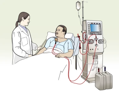 जिल्लाकै उपलब्ध डाइलाइसिस सेवाले मिर्गौला पीडितलाई राहत